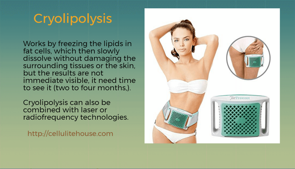 Cryolipolysis- Latest cellulite massage technology 5